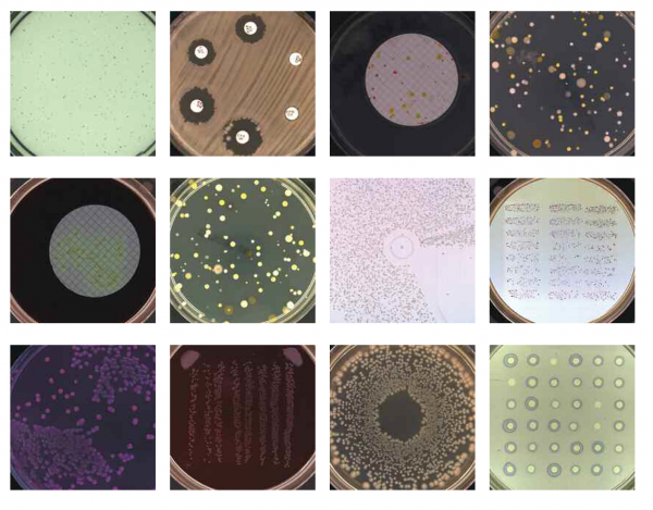 synbiosis, synoptics, colony counter, koloni sayım, koloni analiz, protocol 3, protocol 3 plus, protocol 3 HDE, protocol 3 HDE plus, zone measuring, koloni, gen plaza, chromosome, chromoscan